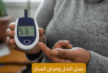 عسل النحل ومرض السكر 9 عسل النحل ومرض السكرHoney and Diabetes