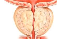 ٢٠٢٤٠٣٢١ ٠٧٢٨٣٠