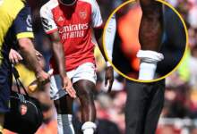 Bukayo Saka is wearing the impact of that high boot from Ryan Christie 6 ٢٠٢٤٠٥٠٤ ١٧٤٤١٧