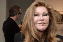 Jocelyn Wildenstein, "Catwoman," dies after a life filled with controversy 6 335444Image1 094411