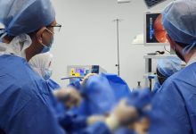 نجاح جراحة دقيقة بمجمع السويس الطبي لاستئصال بطانة الرحم المهاجرة باستخدام المنظار الجراحي 7 IMG 20250426 WA0000