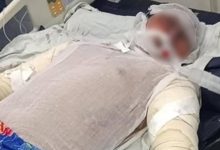 وفاة بطل حريق باكيات مترو شبرا الخيمة بعد صراع مع التسمم الدموي والحروق 7 IMG ٢٠٢٥٠٨١٤ ١٤٣٧٠٤