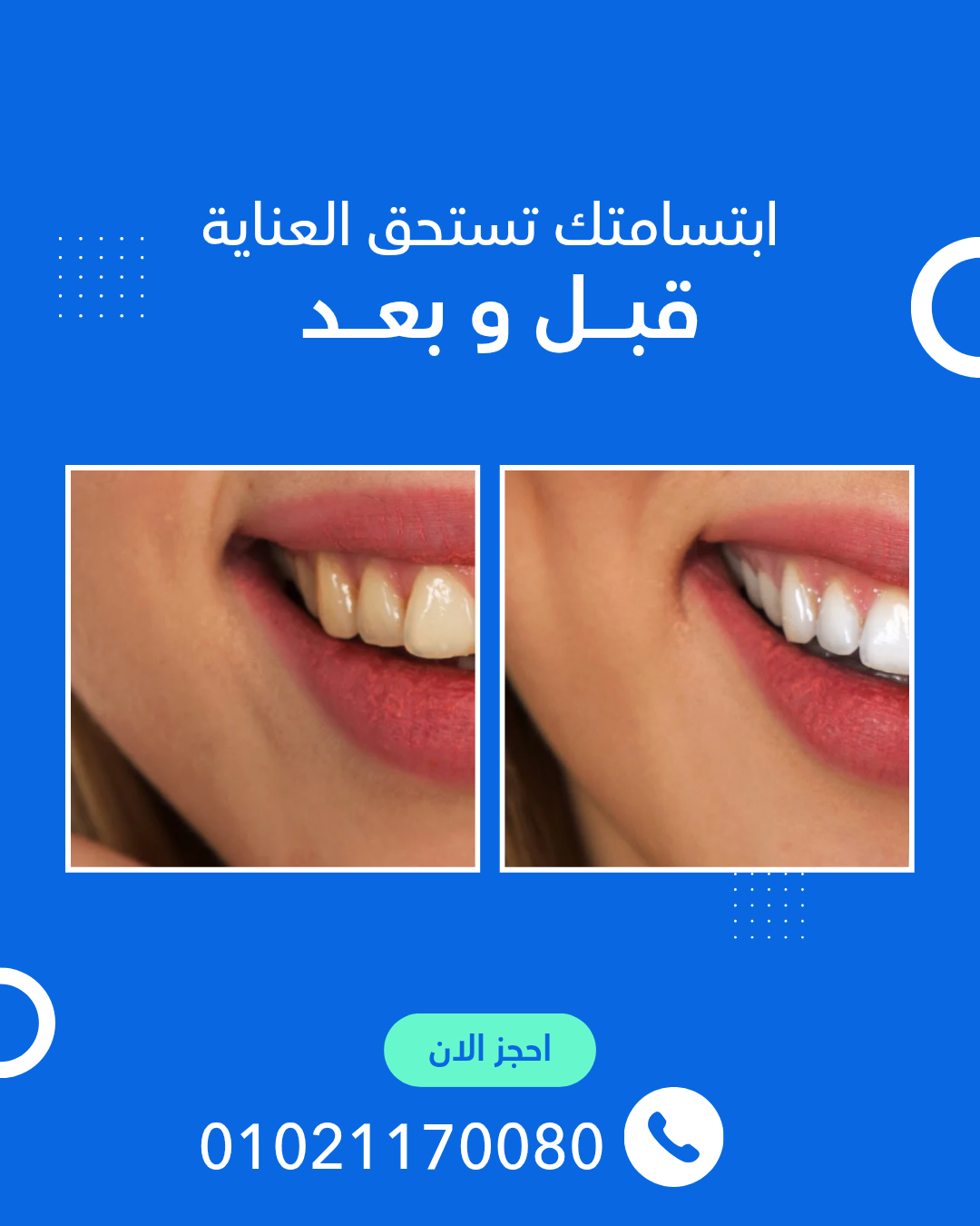 أول مركز معتمد أسنان السويس