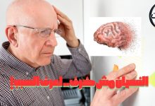 كثرة النسيان ليست دائمًا خرفًا.. أسباب صحية قابلة للعلاج يجب الانتباه لها